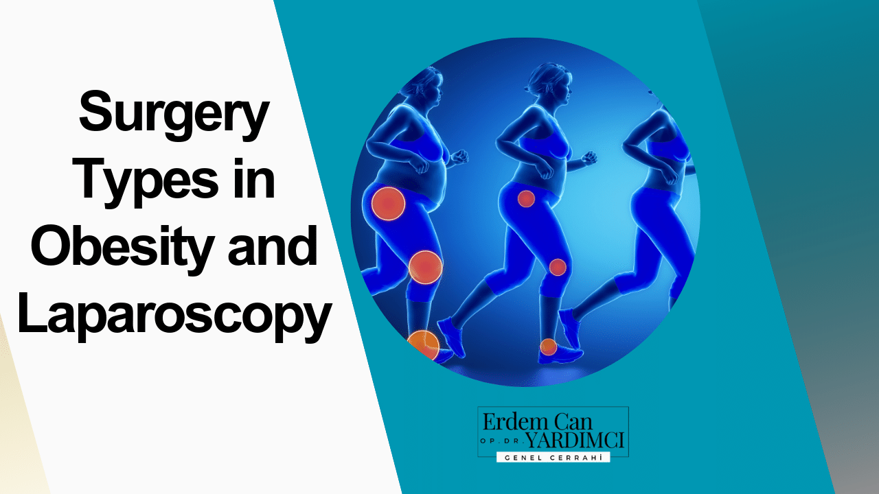 Surgery Types in Obesity and Laparoscopy