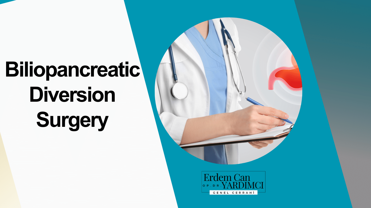 Biliopancreatic Diversion Surgery